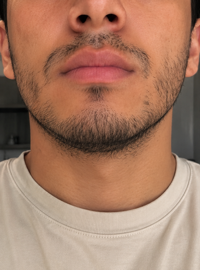 Antes