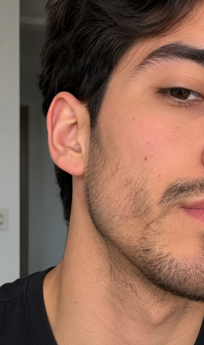 Antes