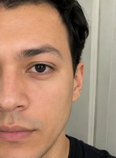 Antes